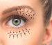 Discover-the-benefits-of-eyelid-aesthetic-blepharoplasty-in-turkey